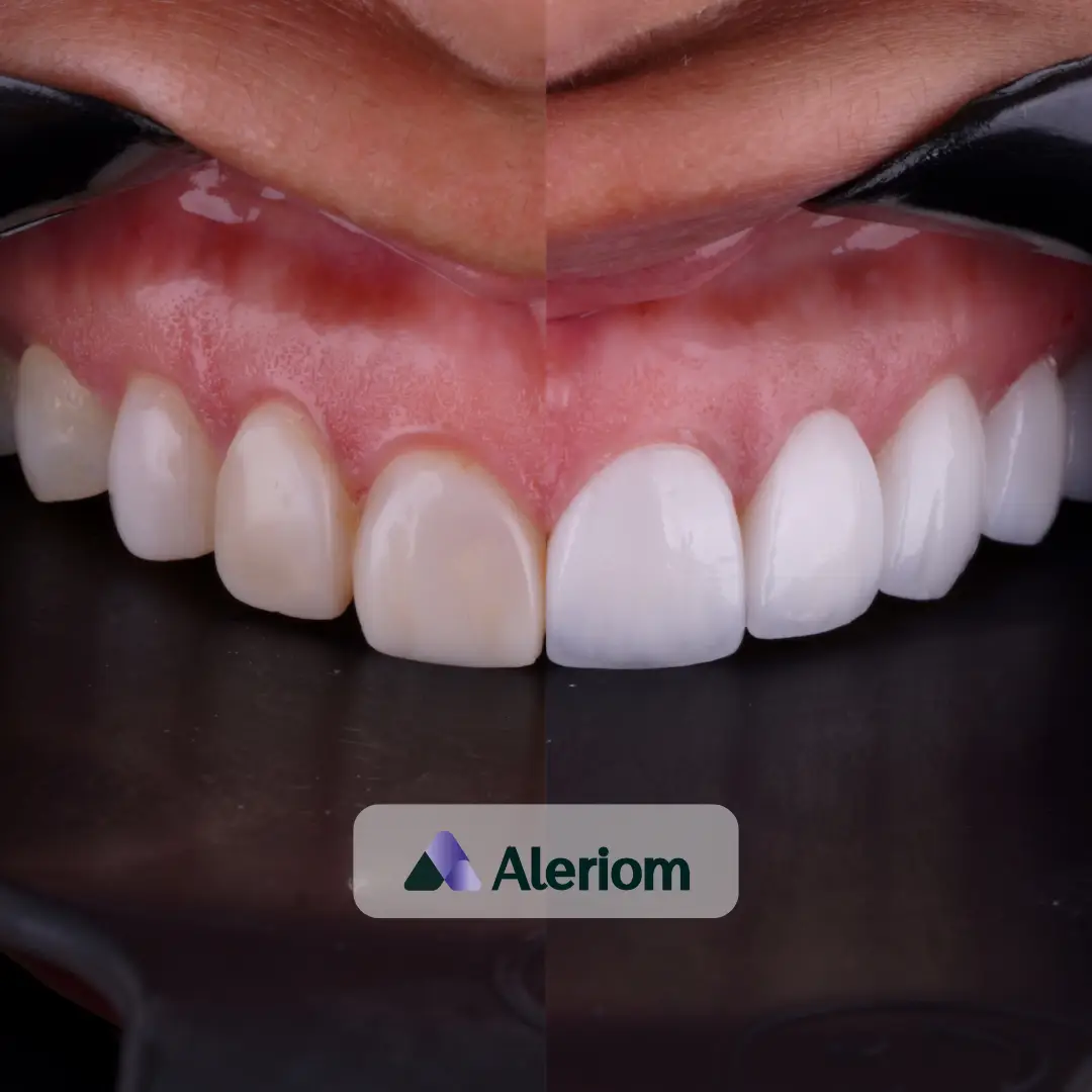 Travel with Aleriom and Get Exceptional Dental Results