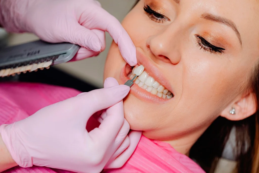 types of dental veneers