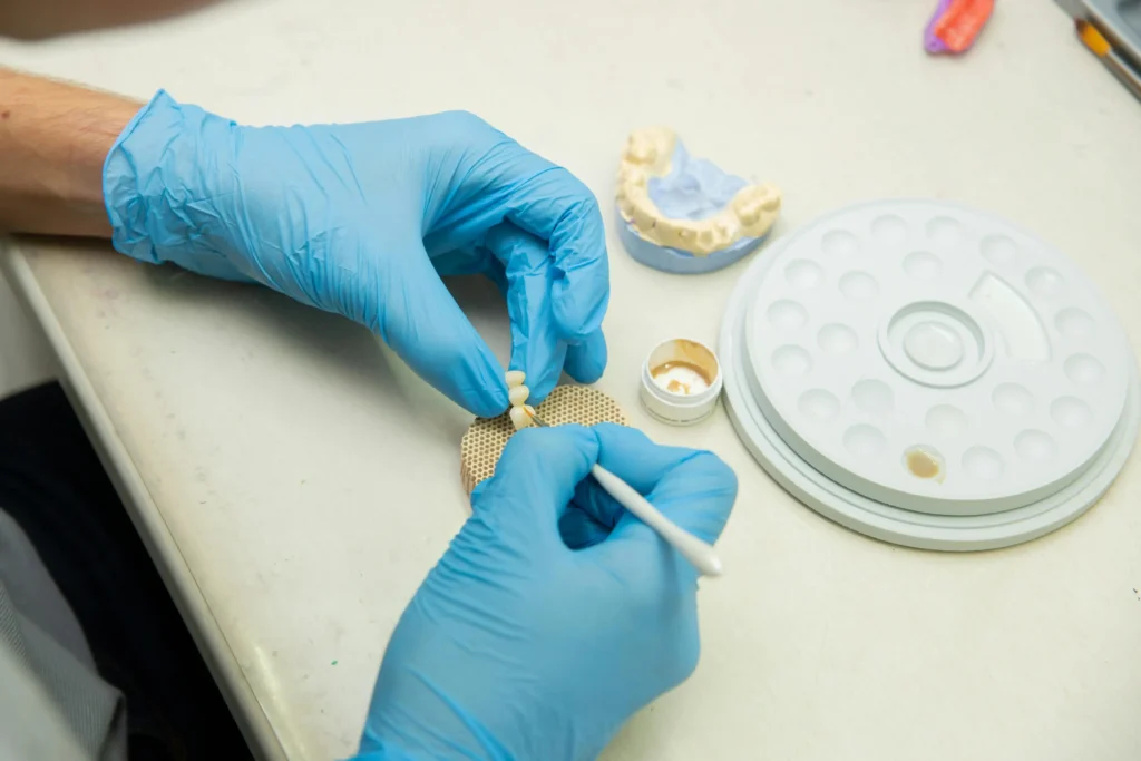 dentures vs all-on-4-implants